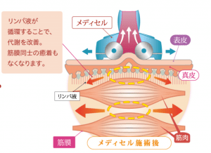 メディセル