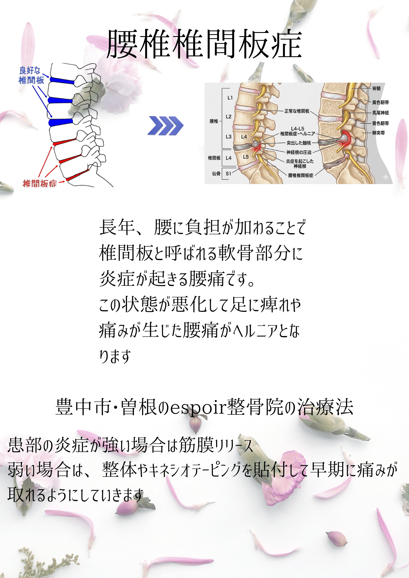 腰痛について - 4