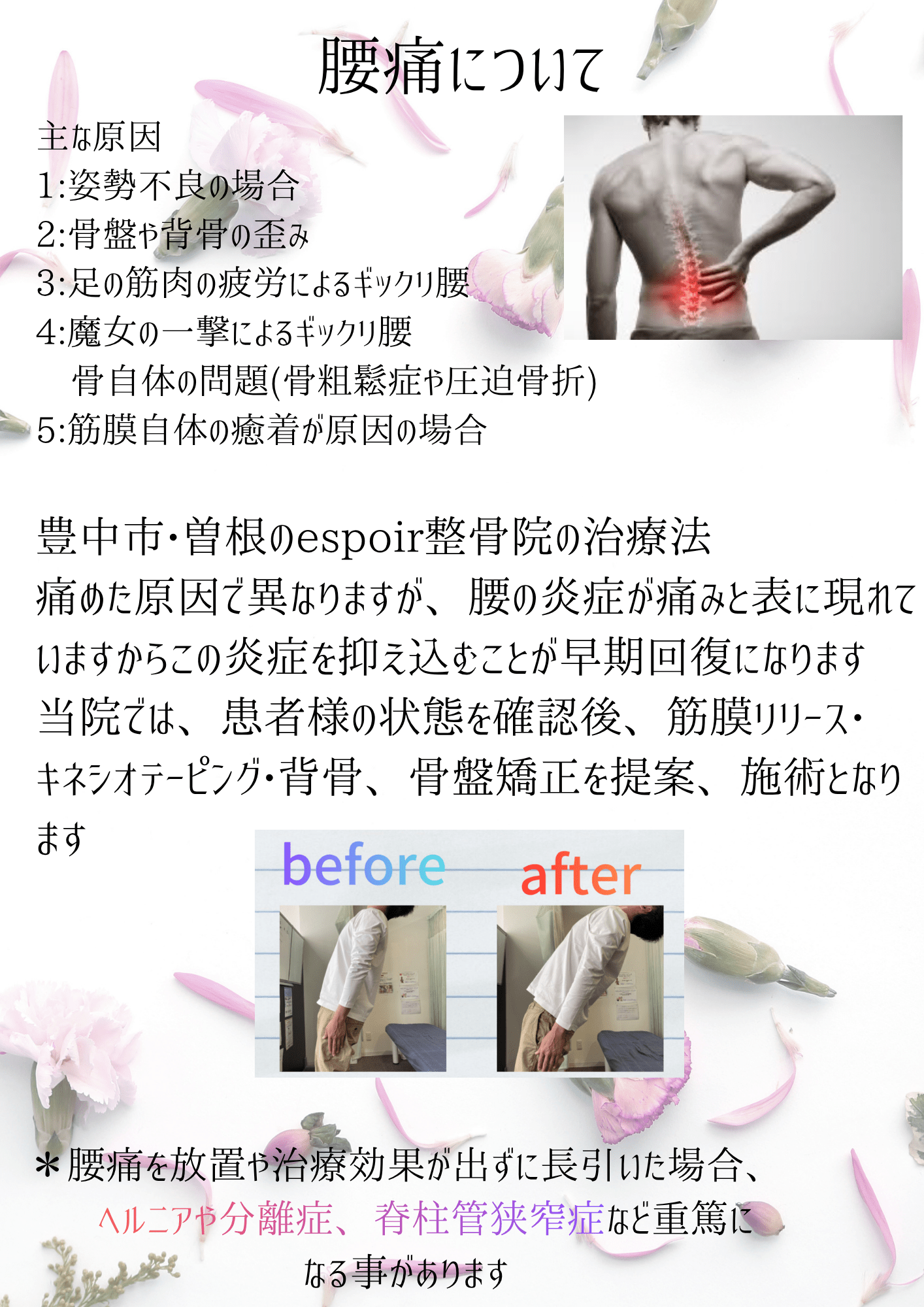 腰痛について - 1